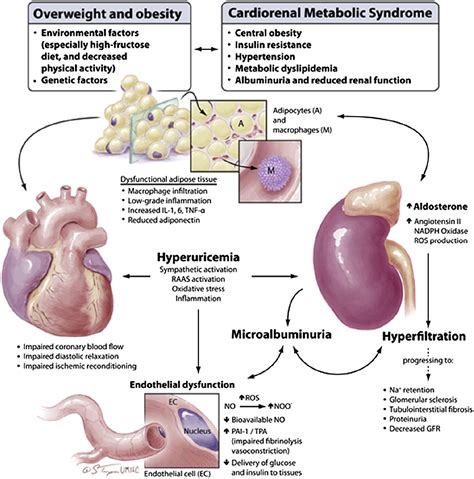 Diabetic Kidney Disease And The Cardiorenal Syndrome Endocrinology