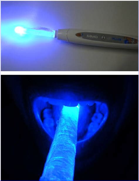 New Blue Light Emitting Diode Led Device For Photodynamic Therapy