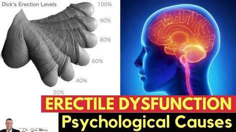 💋psychological Causes Of Erectile Dysfunction All About Sexual