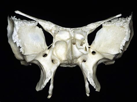 Removing the backbone and breastbone from a whole turkey makes it cook faster, which means less time in the oven for it to dry out. Anterior View of Sphenoid Bone | Neuroanatomy | The ...