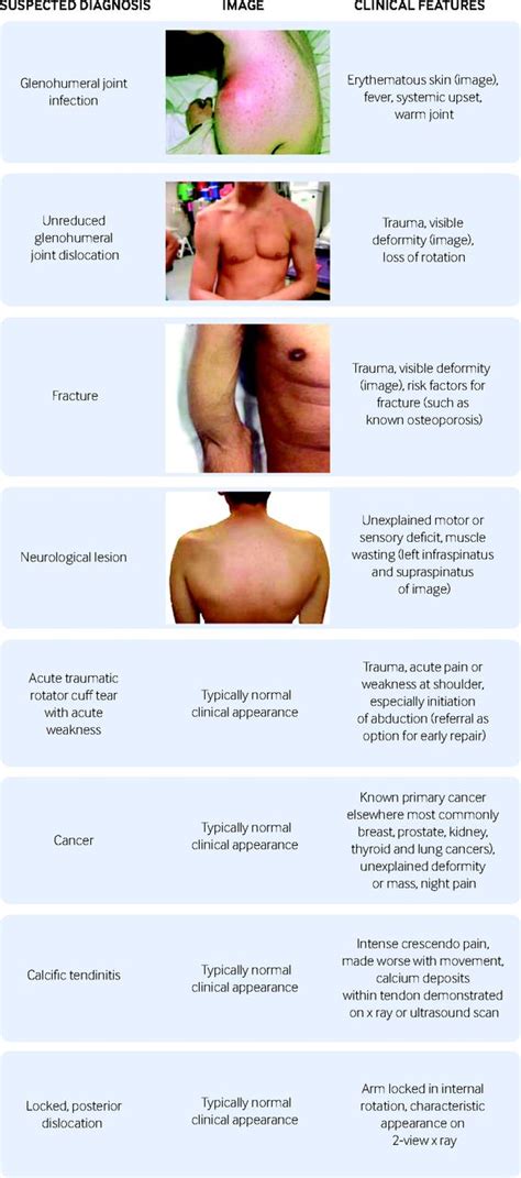 Assessment Of Shoulder Pain For Non Specialists The Bmj
