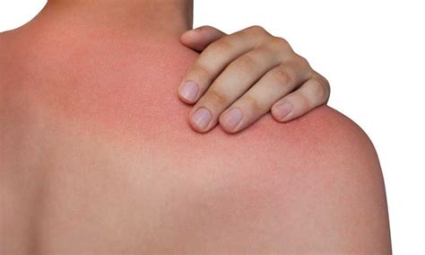 Signs Of Sun Damage To Your Skin How To Reverse It Vibrance Medspa