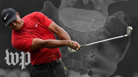 The Spinal Surgery That Made The Tiger Woods Comeback A Reality Youtube