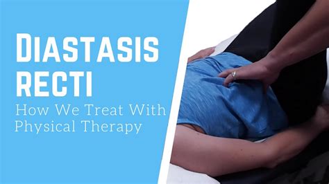 How We Treat Diastasis Recti Physical Therapy Youtube