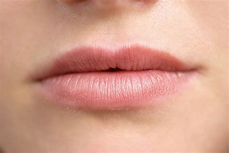 How To Get Rid Of A Fungal Infection On Your Lips Lipstutorial Org