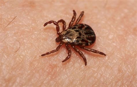 Tick Bites Leading To Rise In Red Meat Allergies