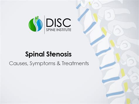 Spinal Stenosis Causes Symptoms And Treatment Options Disc Spine