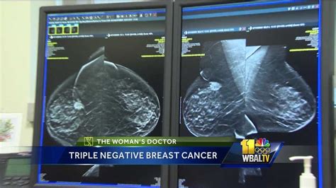 Womans Doctor Triple Negative Breast Cancer More Rare Form Of Cancer