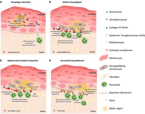 Frontiers Skin Barrier And Autoimmunity—mechanisms And Novel