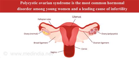 ten most common gynecological problems every woman must know