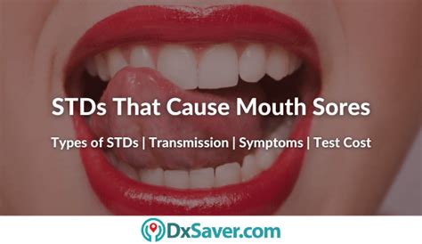 What Types Of Stds Cause Mouth Sores Know More On Other Symptoms And