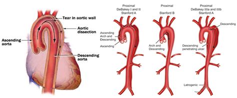 Its main function is to convey oxygen to the lungs, where it can enter the blood stream and to remove carbon dioxide, which escapes from the blood into the lung spaces. The Blood Vessel That Carries Blood From Gut To The Liver ...