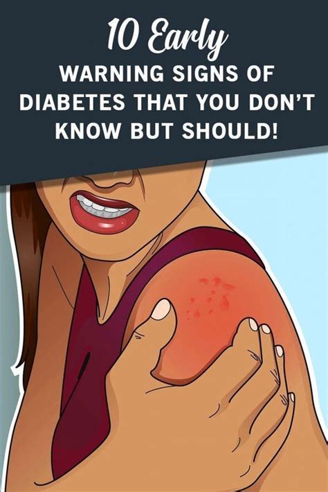 10 Early Warning Signs Of Diabetes Everyone Should Know Health Autos
