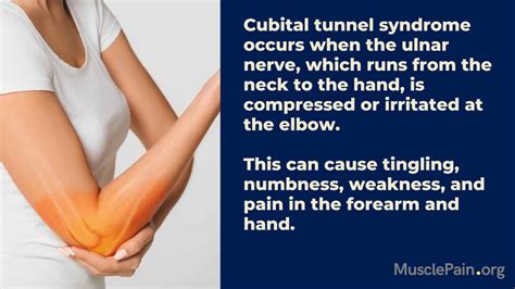 Medial Epicondylitis Vs Cubital Tunnel Syndrome Understanding The