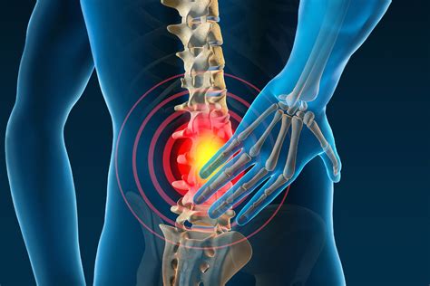 Homeopathic Treatment For Back Pain Sofea Homeopathy Center