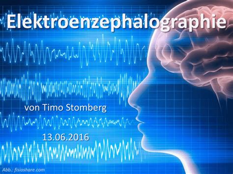 Elektroenzephalographie Epileptologie Bonn