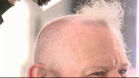 People Go Bald To Rise Money For Cancer Research Wluk