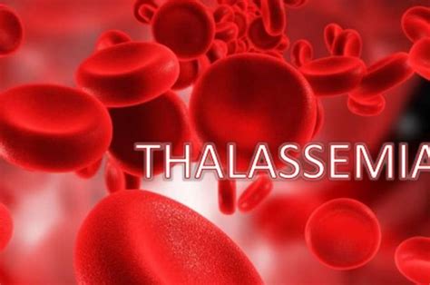 Mengenal Thalassemia Beta Kelainan Darah Yang Diturunkan Orang Tua