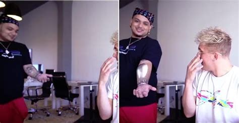 Did A Vlogger Have A Video Camera Surgically Put Into His Arm Fact