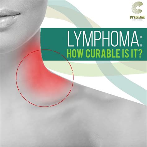 Is Lymphoma Curable Lymphatic Cancer Cytecare