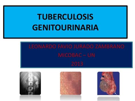 Tuberculosis Genitourinaria Y Abdominal