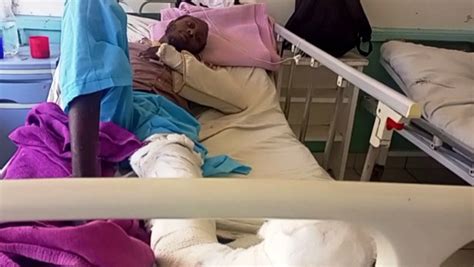 K24 Tv On Twitter Sorry State At Thika Level 5 Hospital As Patients With Broken Limbs Await