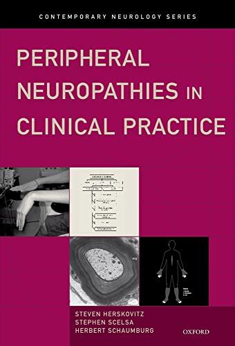 Peripheral Neuropathies In Clinical Practice Contemporary Neurology