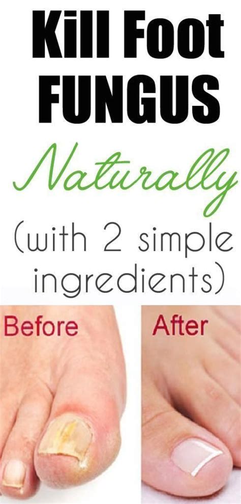 Grab Your Health How To Get Rid Of Foot Fungus Naturally Look At This