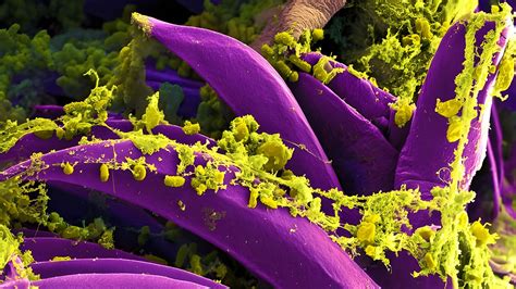 Oregon Health Officials Confirm First Human Bubonic Plague Case Since