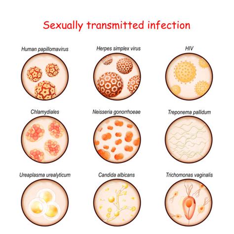Gonorrhea Bacterium Illustrations Royalty Free Vector Graphics And Clip