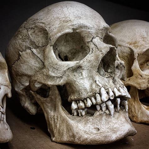 Skulls And Bones Skull Human Skull Photography Skull Anatomy