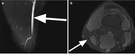 Arteries And Nerves Radiology Key