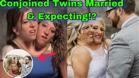 Brittany Abby Conjoined Twins Major Update Married What Else