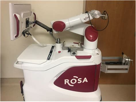 Children Free Full Text Robotic Stereotactic Assistance Rosa For