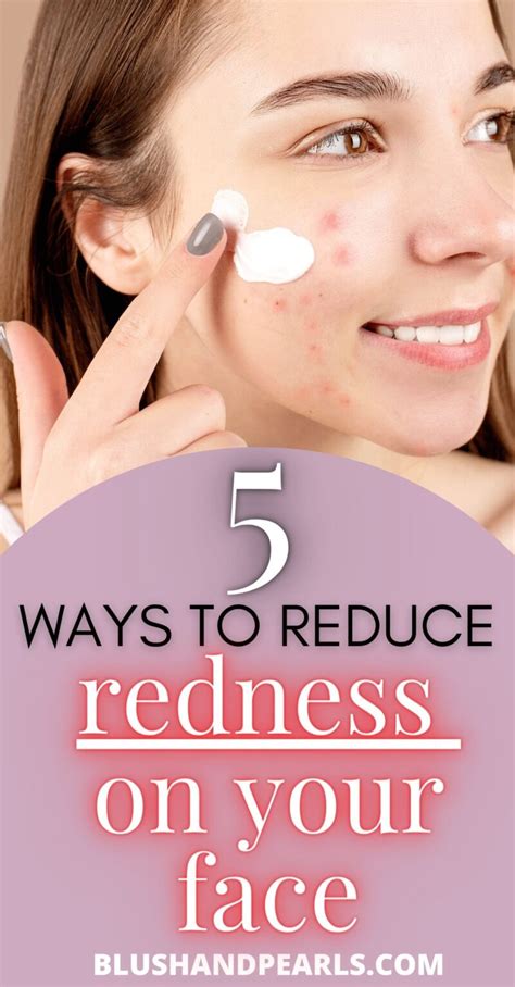5 Ways To Manage Facial Redness