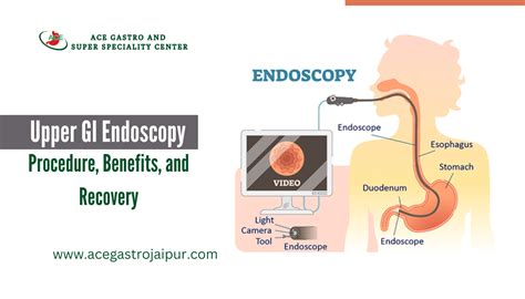 What Is Upper Gi Endoscopy Procedure Benefits And Recovery Ace Gastro