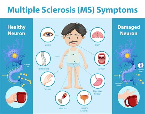 Symptoms Of Ms Symptoms Of Multiple Sclerosis Ms Belongms Symptoms
