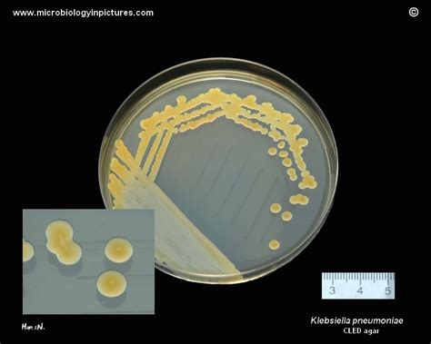 Klebsiella Pneumoniae On Cled Agar Lactose Positive Yellow Colonies