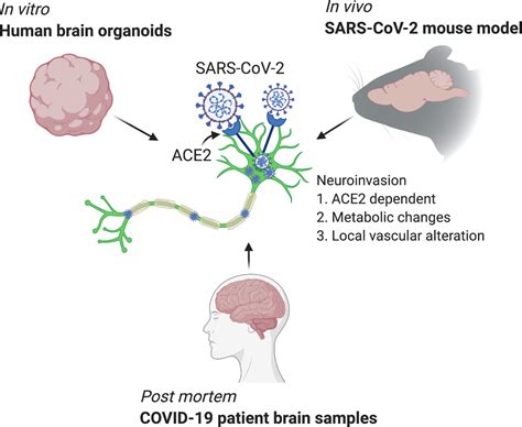 Mechanisms Underlying Sars Cov 2 Neuroinvasion Discovered