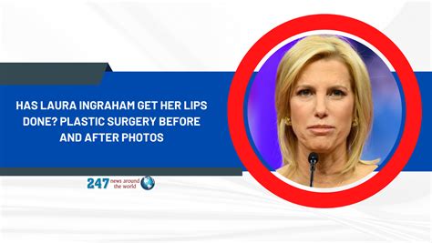 has laura ingraham get her lips done plastic surgery before and after photos 247 news around