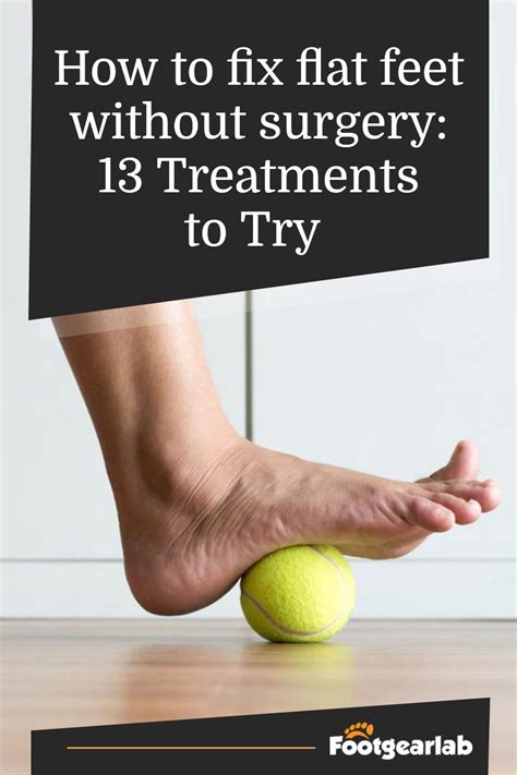 How To Fix Flat Feet Without Surgery 13 Treatments To Try In 2021 How To Fix Flat Feet Flat