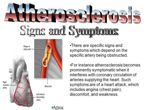 Atherosclerosis Cardiovascular Disease Symptoms