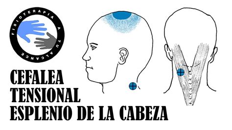 Dolor De Cabeza Arriba De La Nuca Mentalidad Humana