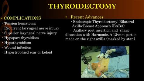 Thyroidectomy Operative Surgery