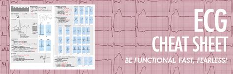 Free Printable Ekg Cheat Sheet My Xxx Hot Girl