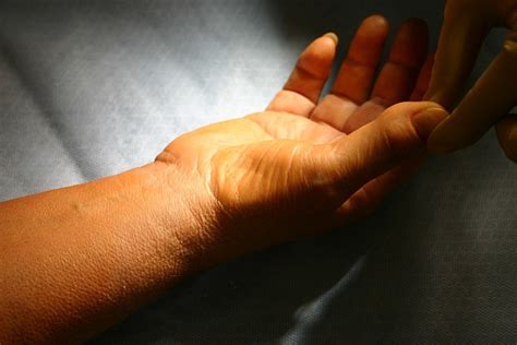 Early Warning Signs Of Carpal Tunnel Syndrome And How To Keep Hands Wrists Healthy