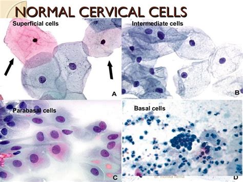 Cervical Cytology Cells Labeled