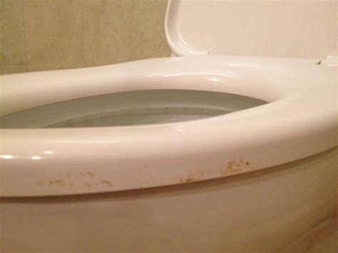 These Photos Of The Most Disgusting Hotels In The World Will Make You