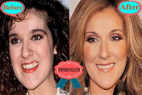 Celine Dion Cosmetic Dentistry Before And After Top Piercings