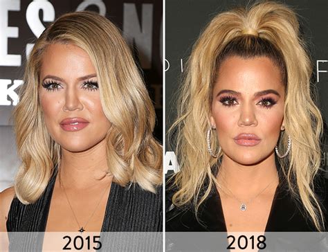 Khloé Kardashian Then And Now See How Much Her Face Has Changed Over The